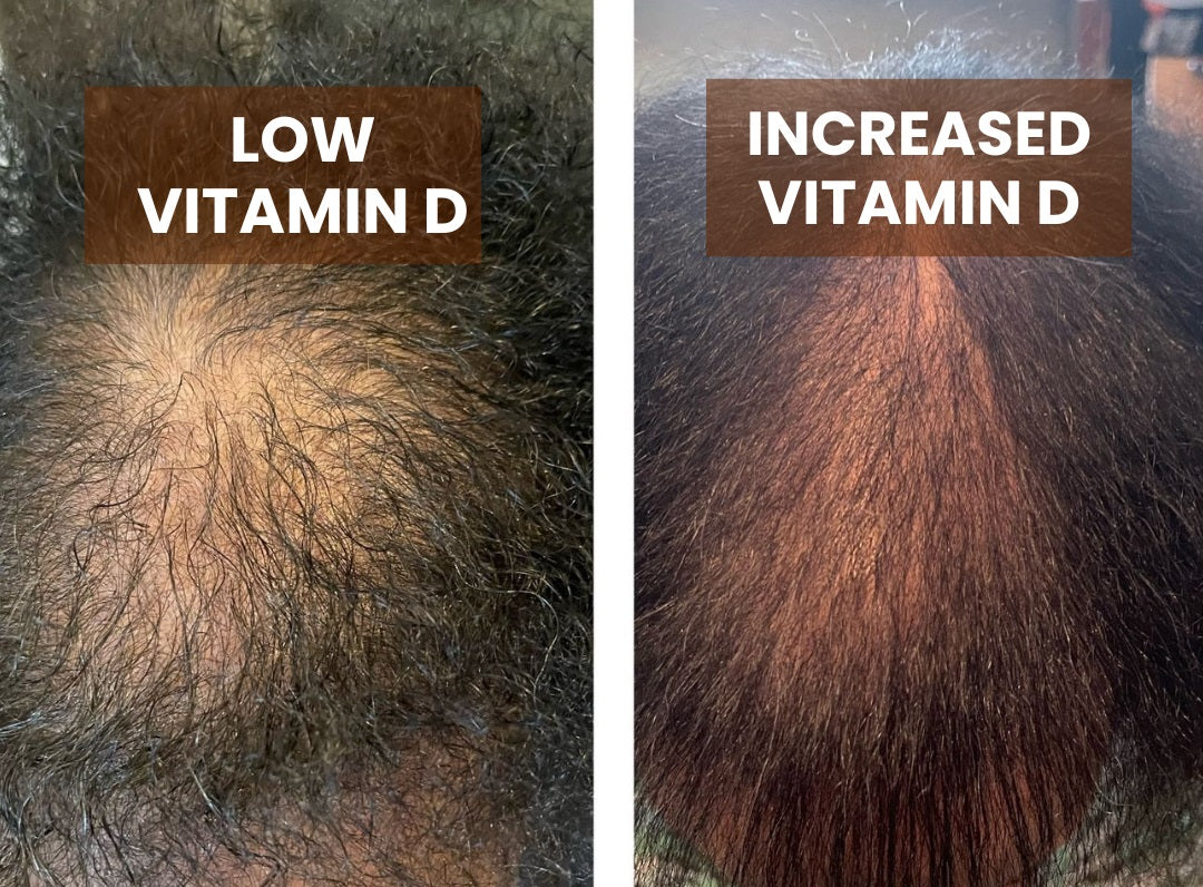 Vitamin D3 & K2